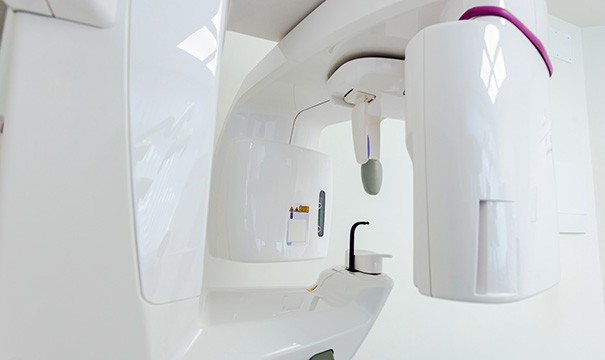 The CBCT scanner can take panoramic scans of your entire mouth