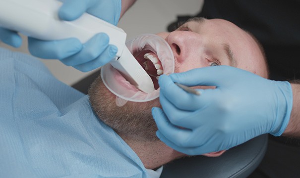 Dental digital impressions replace the need for messy putty molds used in years past