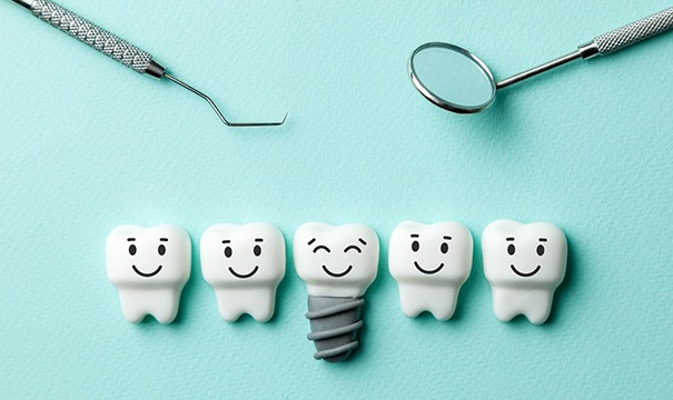 Illustration of dental implant in Newton