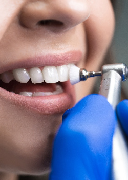 A woman getting a dental cleaning near West Newton