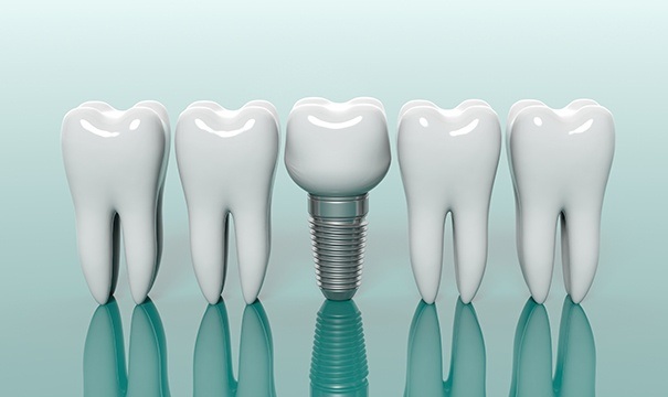 Animated row of teeth and an implant supported dental crown