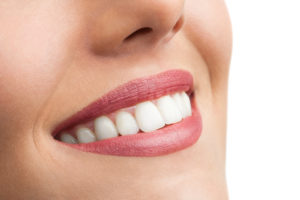 Beautiful white smile with veneers from a cosmetic dentist