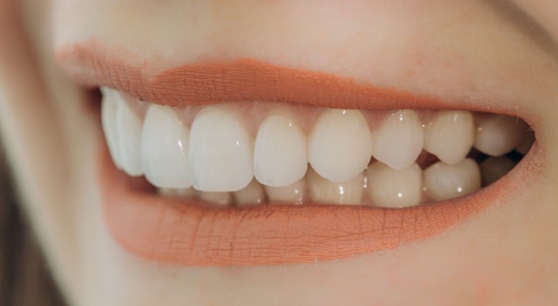 Closeup of woman smiling with veneers in Newton