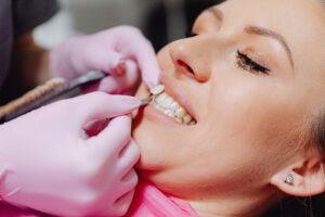 Close up of a veneer next to a woman’s tooth