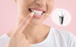 Woman smiling and pointing to her dental implant